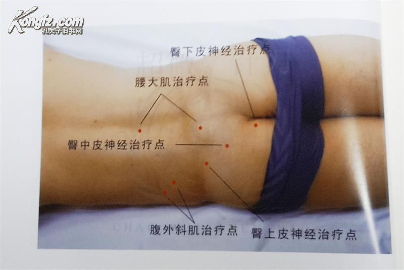 超微针刀培训：从技术门槛到临床落地的系统化进阶路径